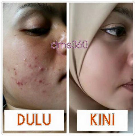 testimoni dms 360