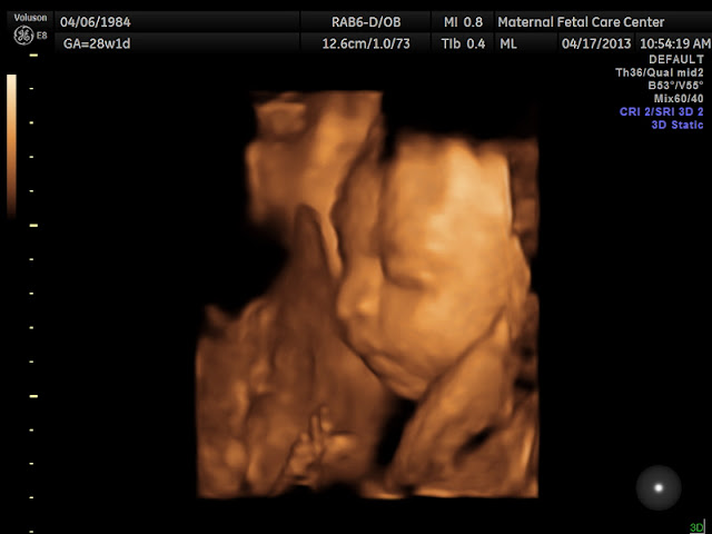 3d Image 17 Weeks Pregnant | 3d Cake Image