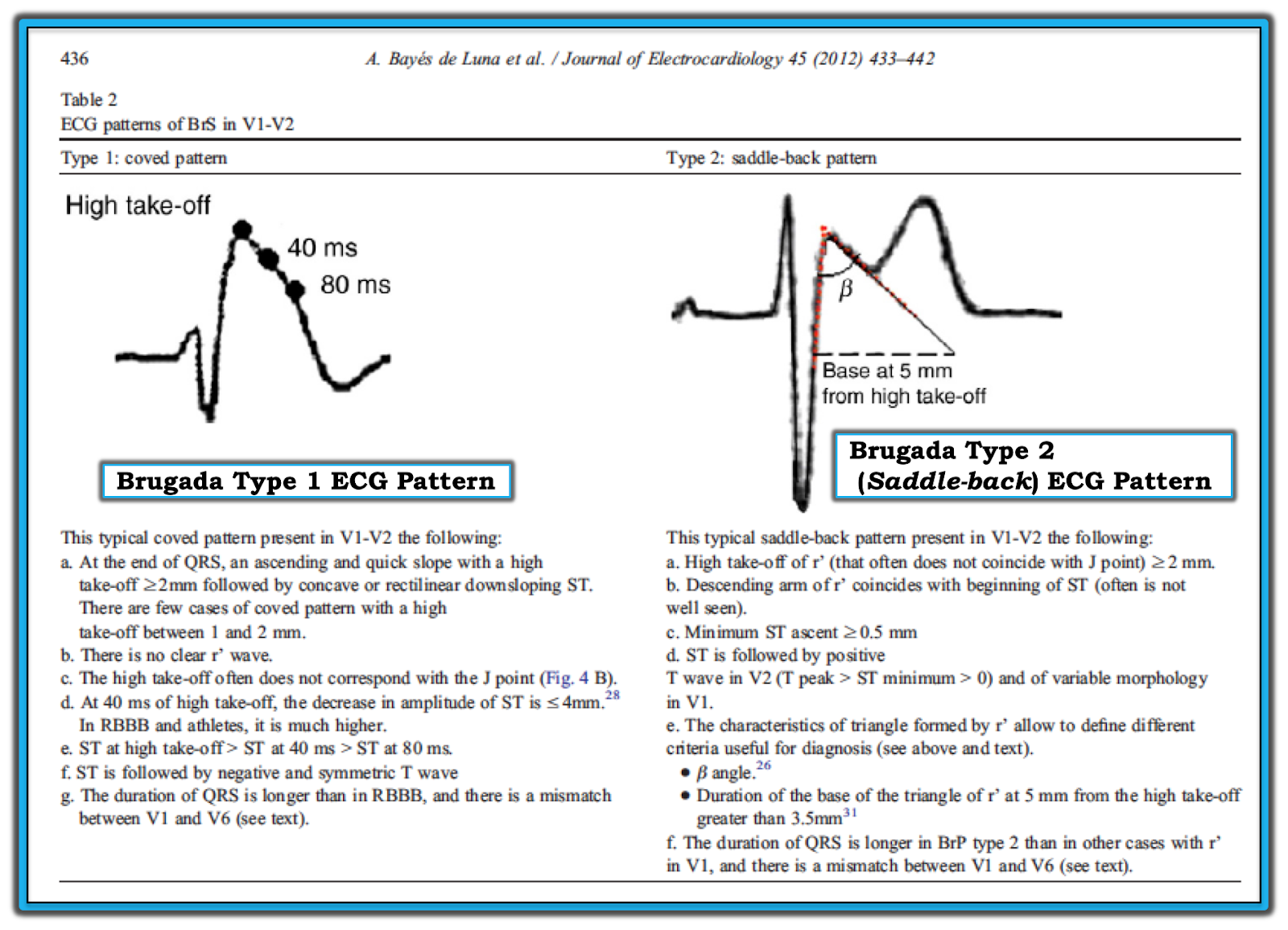 dr-smith-s-ecg-blog-hyperthermia-and-st-elevation