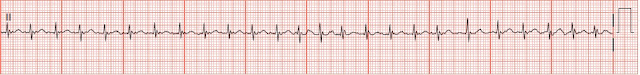 Ekg with rhythm strip, adult young toon porn