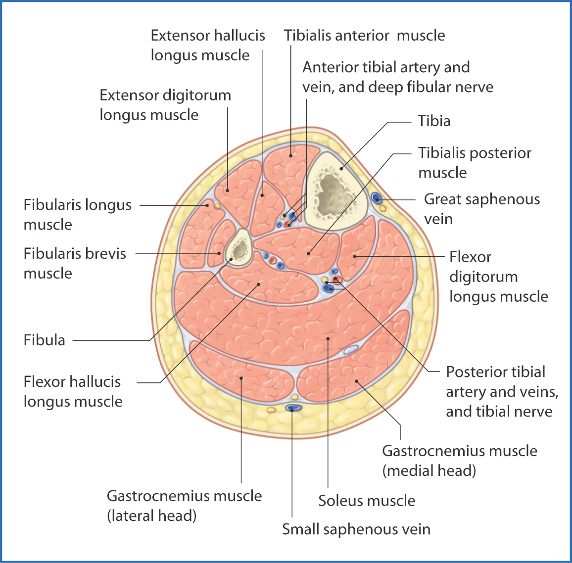 Below Knee Amputation Video and Steps | World Surgery Forum