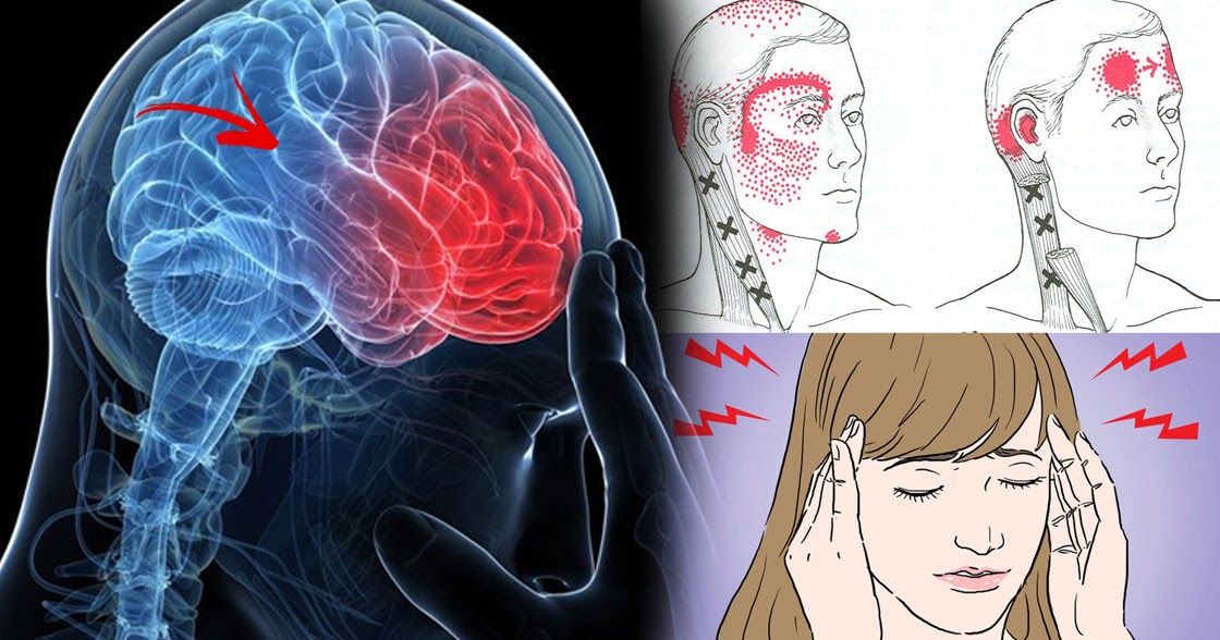 These Food Items Can Cause Headache Stop Eating Them Frequently