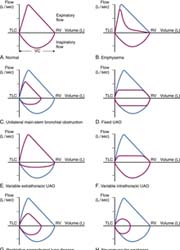 function volume pulmonary flow obstruction obstructive fev1 normal fvc tests anesthesia lung airway loops extrathoracic variable copd comparison respiratory restrictive
