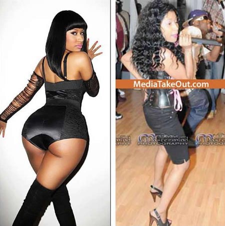 Nicki-Minaj_before-and-after-plastic-surgery.jpg