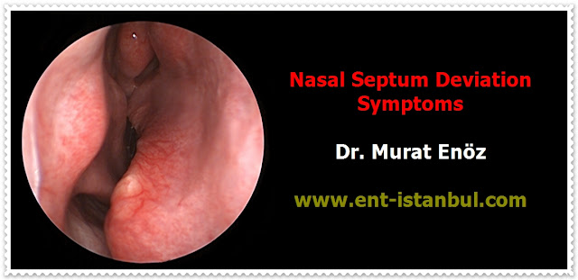 Nasal septum deviation definition - Nasal septum deviation causes - Symptoms of deviated septum - Diagnosis of septum deviation with turbinate hypertrophy - Treatment of nasal septum deviation - Septoplasty in Istanbul - Septoplasty in Turkey