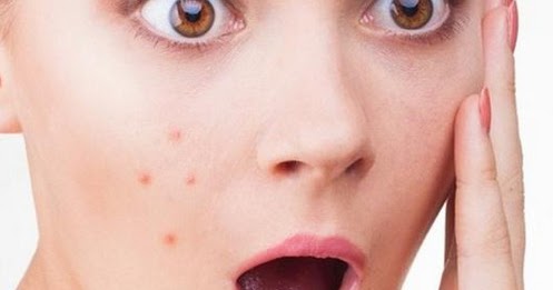 12 Arti Jerawat Leher Menurut Primbon Dan Psikologi Terlengkap Arti Jerawat Leher