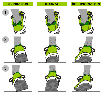pronierer oder supinierer