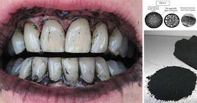 I Brushed My Teeth With Activated Charcoal For A Week I Brushed My Teeth With Activated Charcoal For A Week