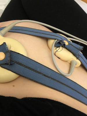 Wann kommt das Baby Schwangerschaftswoche SSW Runzelfuesschen Elternblog Hebammen Erfahrung