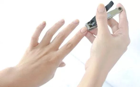 Memotong Kuku dan Rambut Bagi Orang Yang Akan Berqurban