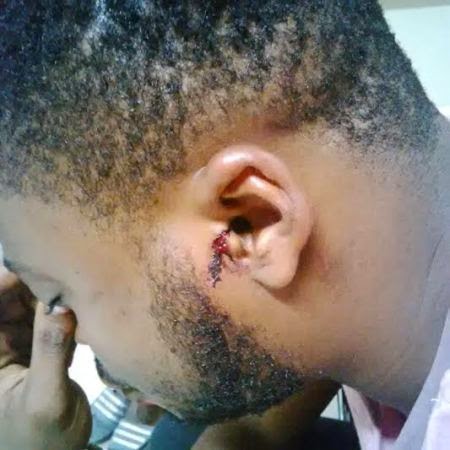 3 Photo: Gospel artist RhymeStar Ray battered by soldiers for wearing camouflage shorts