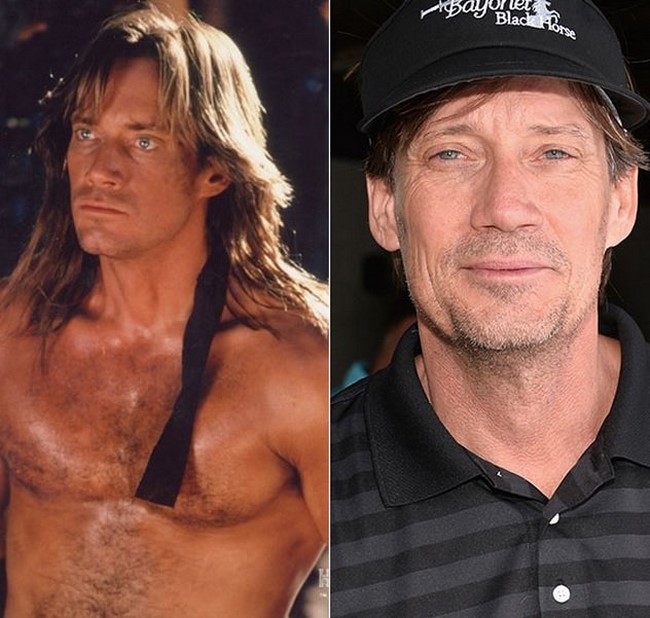 O antes e o depois de grandes estrelas de séries de Hollywood da década de 90