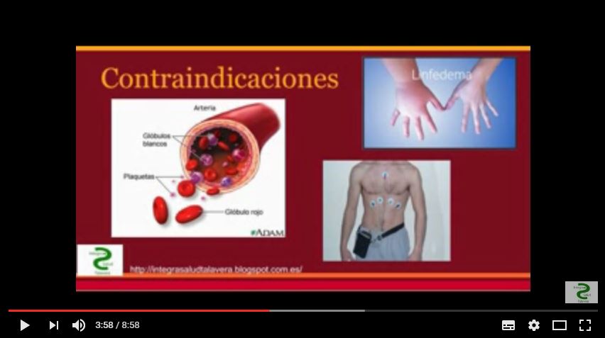 Vídeo explicativo sobre Acupuntura Dra. Nathalie Orens