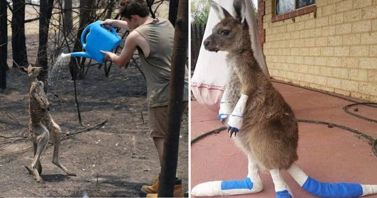 Young Kangaroo With Severe Burns Pleads For Water From A Boy