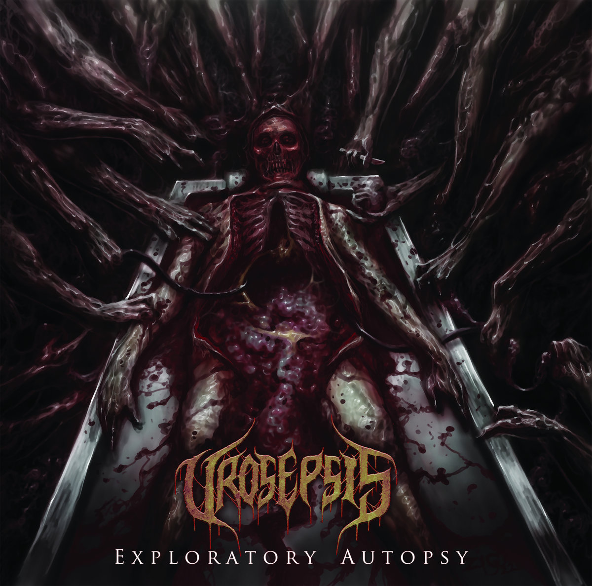 Urosepsis - "Exploratory Autopsy" - 2023