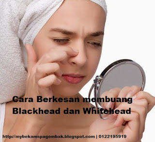 Cara Mudah Hilangkan Blackhead dan Whitehead