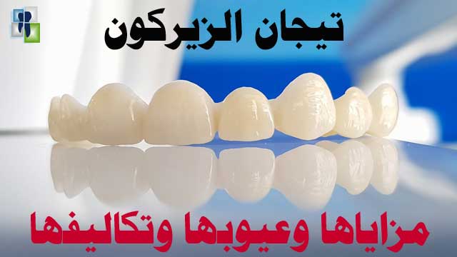 تيجان الزيركون : مزاياها وعيوبها وتكاليفها تيجان الزيركون : مزاياها وعيوبها وتكاليفها