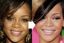 Has Rihanna Had Cosmetic Surgery?