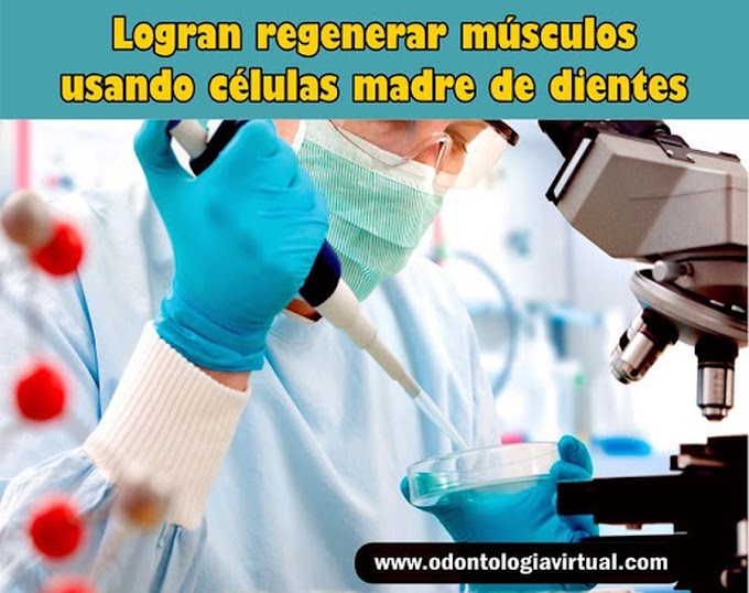 NOTIDENTAL: Logran regenerar músculos usando células madre de dientes