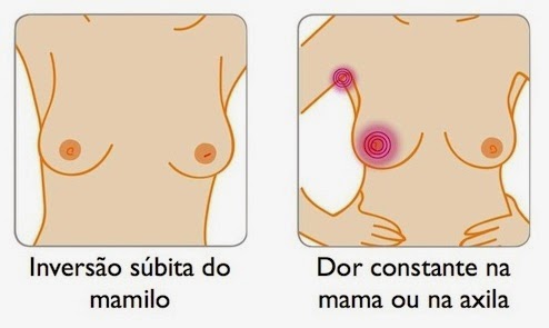 sintomas-cancer-mama-mulher-homem-prevencao-autoexame-mamografia-quimioterapia-dascoisasquetenhoaprendido