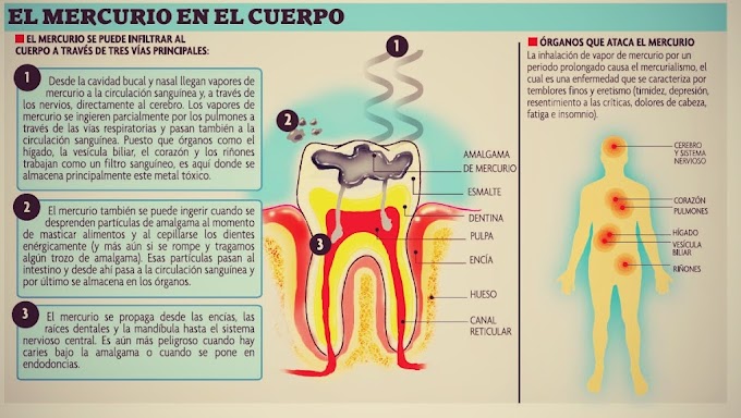 DEBATE: ¿El Mercurio de la Amalgama Dental afecta nuestra salud?