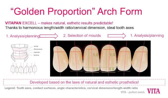 PROSTHODONTICS: VITA Premium Denture Teeth: Breaking the MOLD