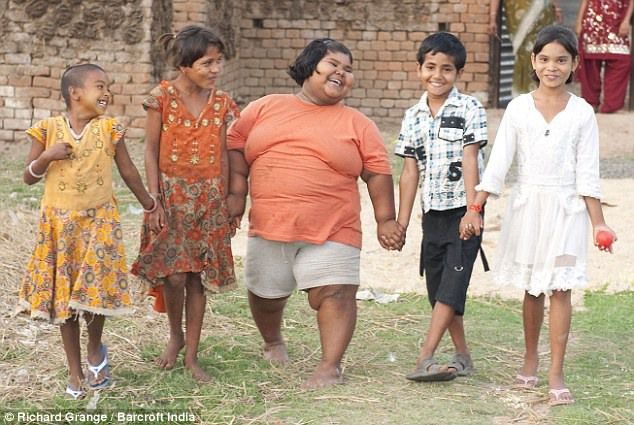 ΠΑΧΥΣΑΡΚΙΑ / Obesity Το πιο χοντρό παιδί του κόσμου