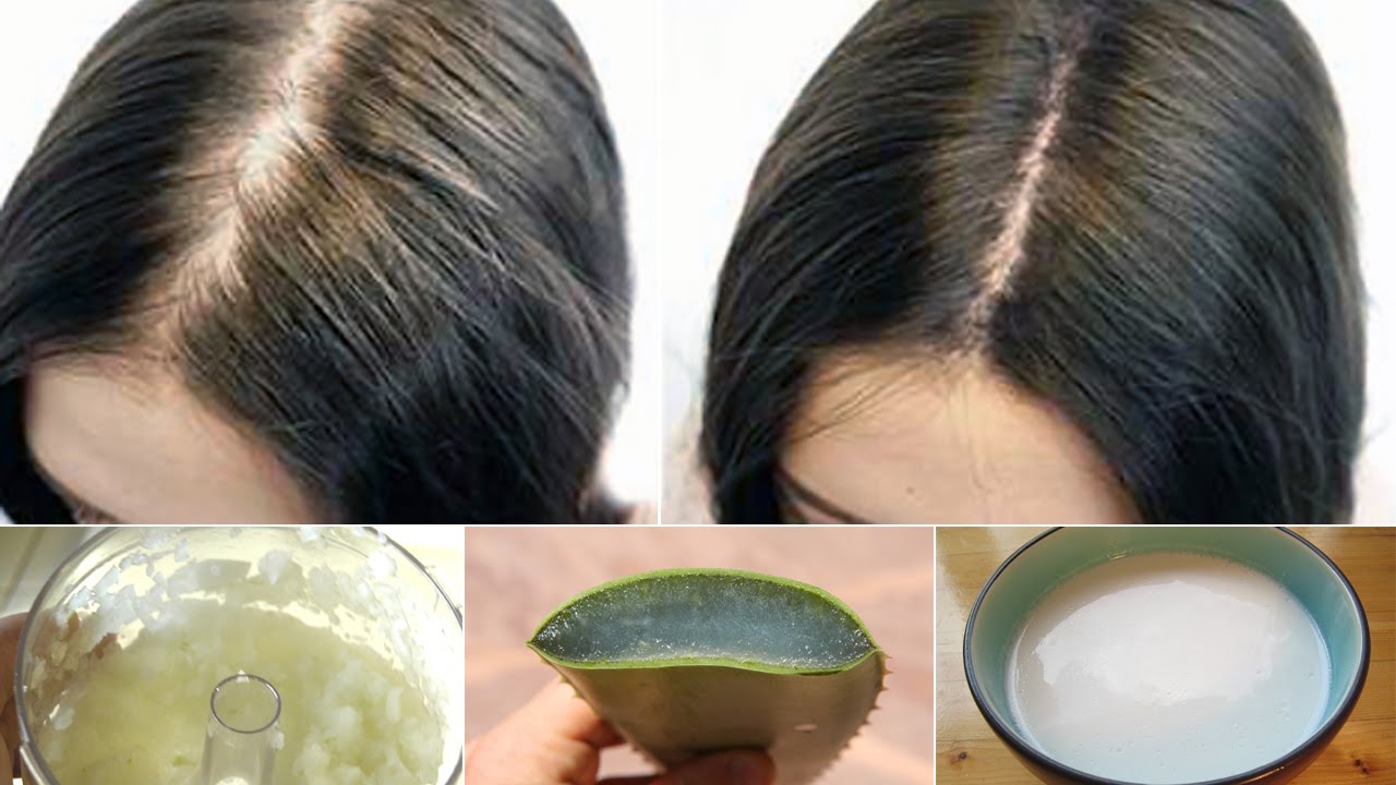 Health Care Tips Hair Loss Best Solution