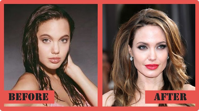 Angelina Jolie Celebrity Plastic Surgery Before And After ...