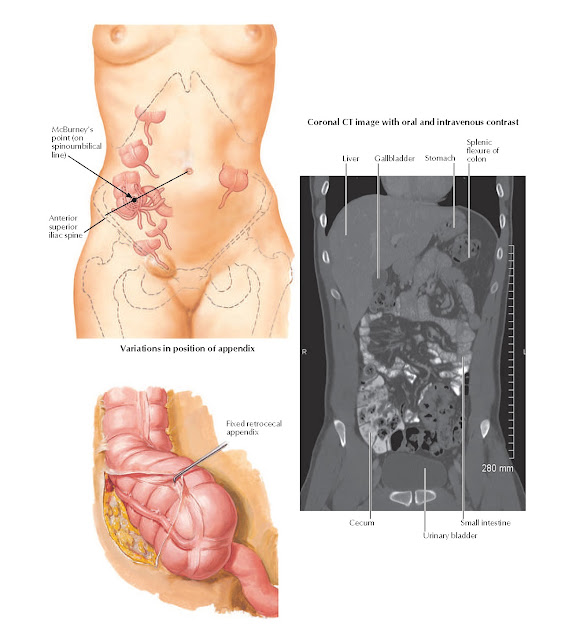 (Vermiform) Appendix Anatomy