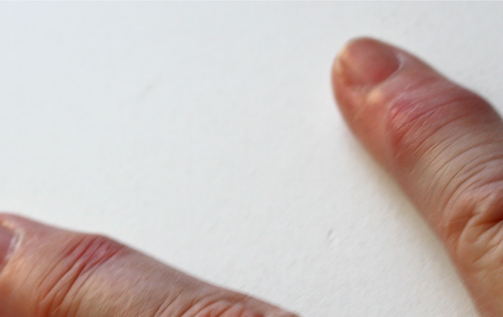 Reasonably Well Psoriatic Arthritis