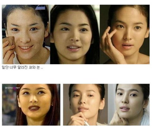 Song Hye Kyo Plastic Surgery Before and After Facelift, Nose Job and