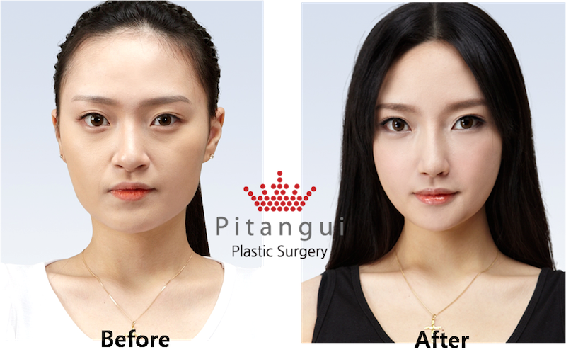 12 Things You Should Look Into Before Considering Plastic Surgery In Malaysia