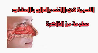 لحمية الانف والعلاج بالاعشاب معلومة من الذاكرة