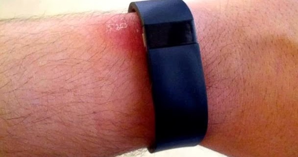 fitbit wrist placement