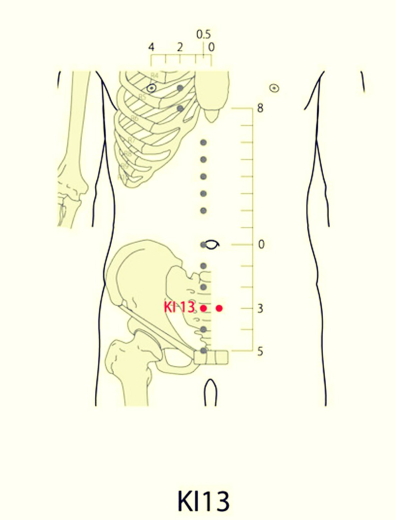 SaroEpic Acupuncture Acupuncture Points for Polycystic Ovarian