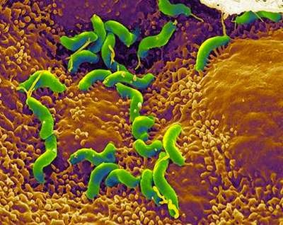 Hình ảnh vi khuẩn HP phóng to trong dạ dày, chúng có thể sống trong môi trường axit, yếm khí và ở sâu dưới lớp nhày của niêm mạc tạo ra độc tố gây viêm loét dạ dày