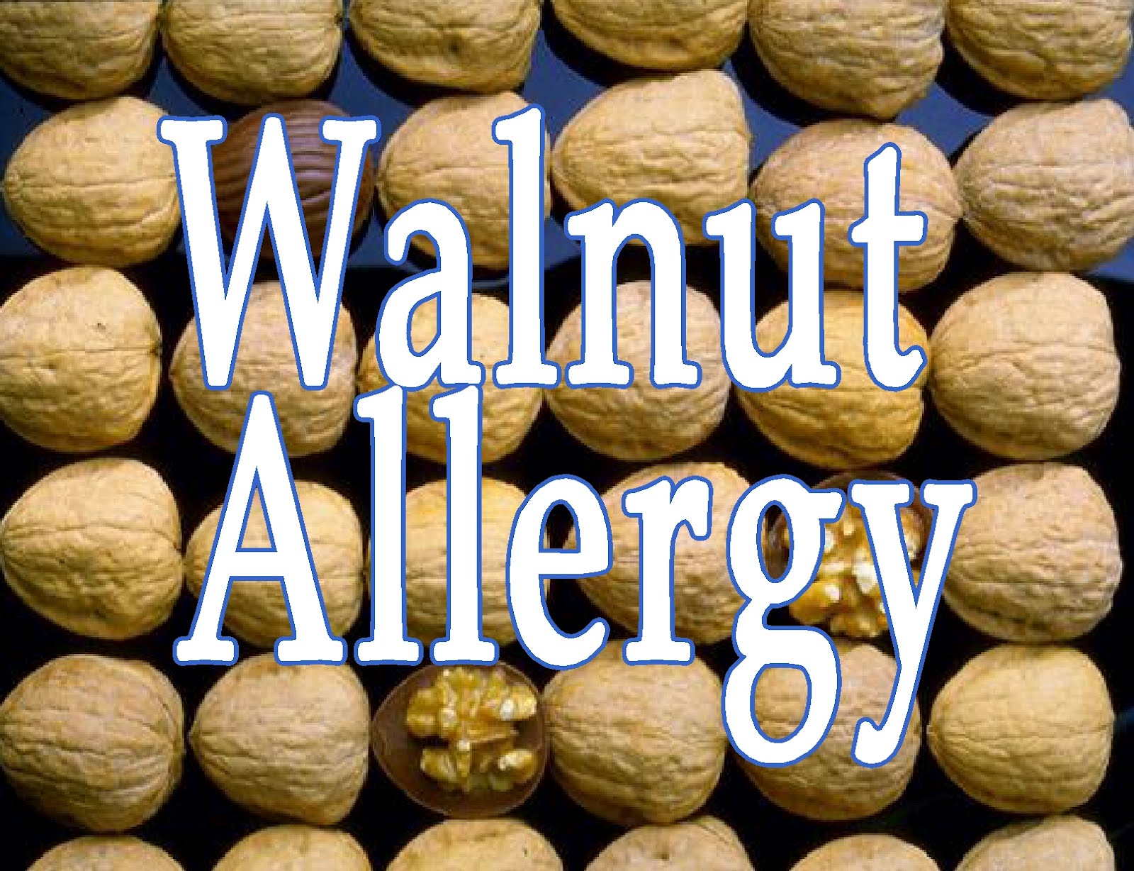 Free Posters and Signs Walnut Allergy