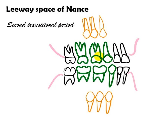 ORTHODONTICS: What is Leeway space of Nance?