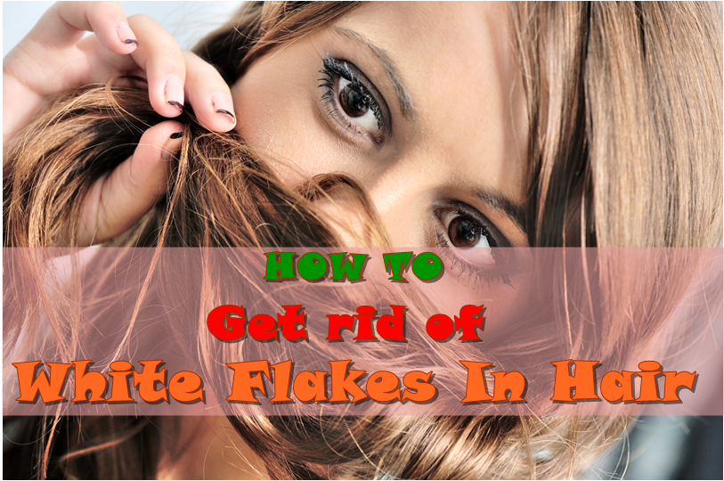 How To Get Rid Of White Flakes In Hair The Curious Mom