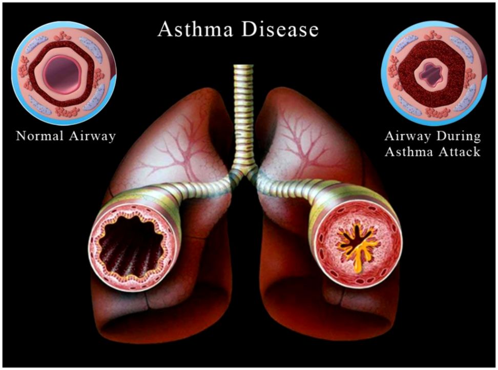 Pictures for Medical PowerPoint Templates in Tampa FL 33647  Design
