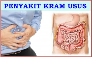 Bahaya, Jangan Mengkonsumsi Vitamin C Teralalu Berlebih