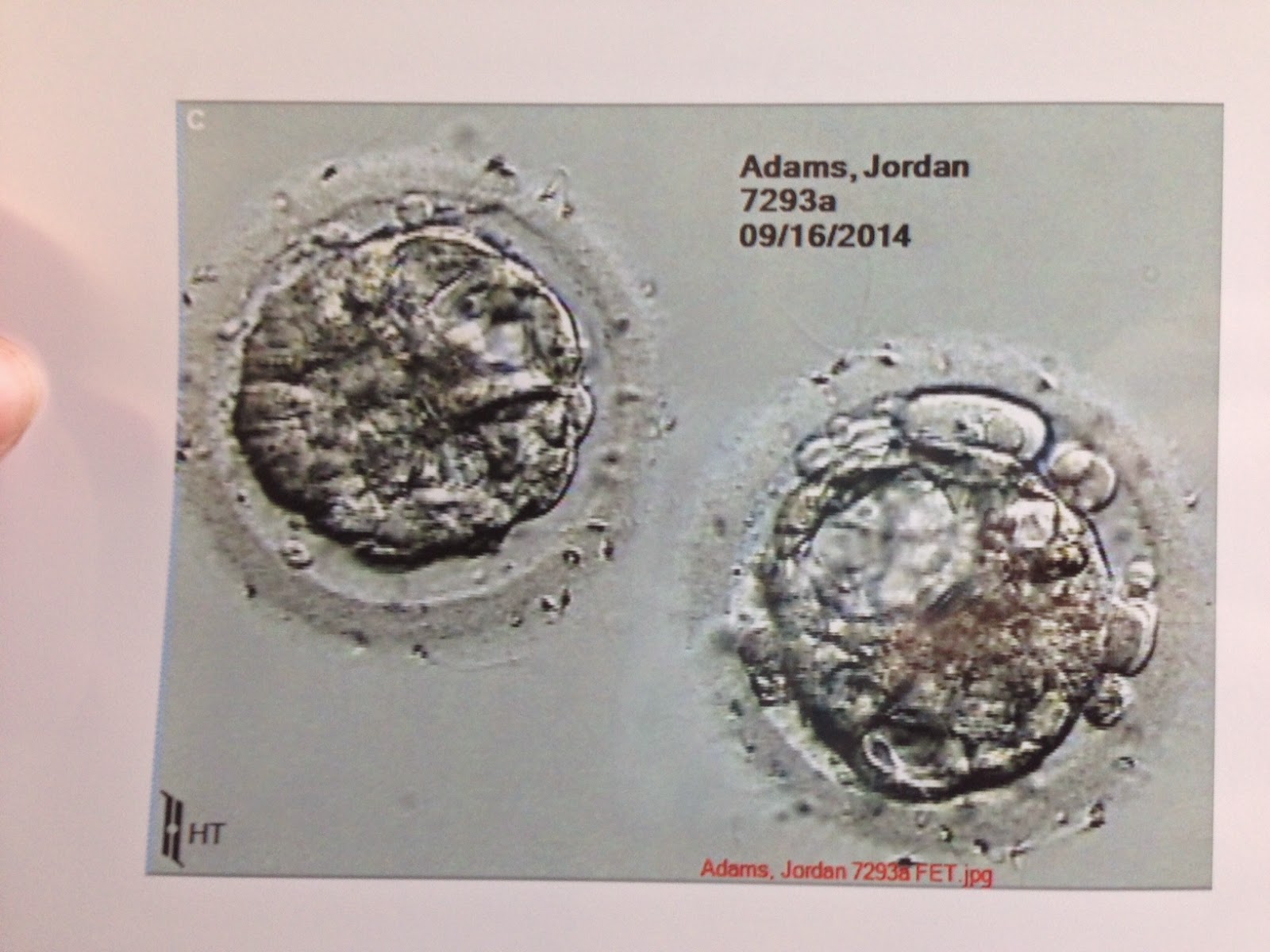 Please Baby Please Our Frozen Embryo Transfer...