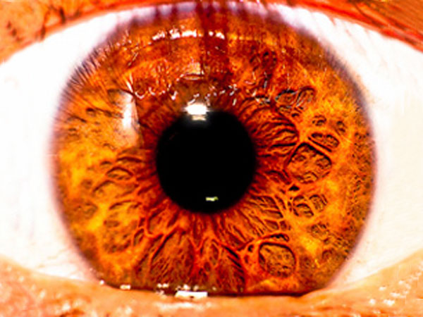 Bizarretas: Los colores de ojos más raros del mundo