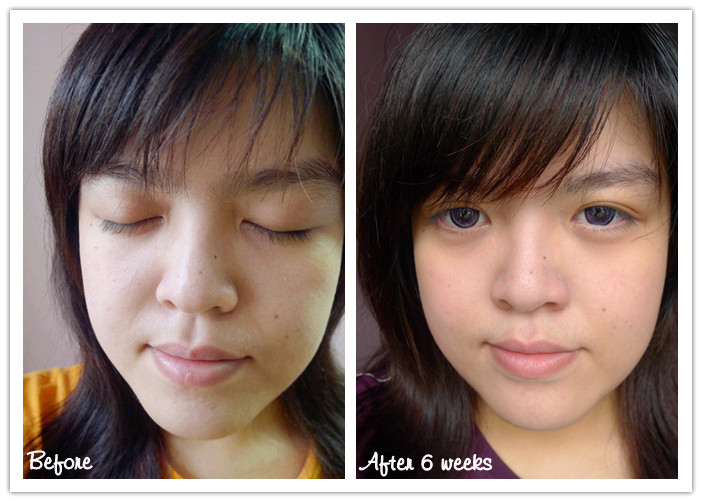 testimoni loreal white perfect