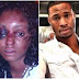 Woman shares details of how she was beaten after date with man she met on Instagram