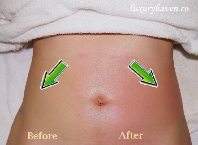 tummy venus freeze aesthetic aesthetics non rid treatments surgical treatment fat accent ultra
