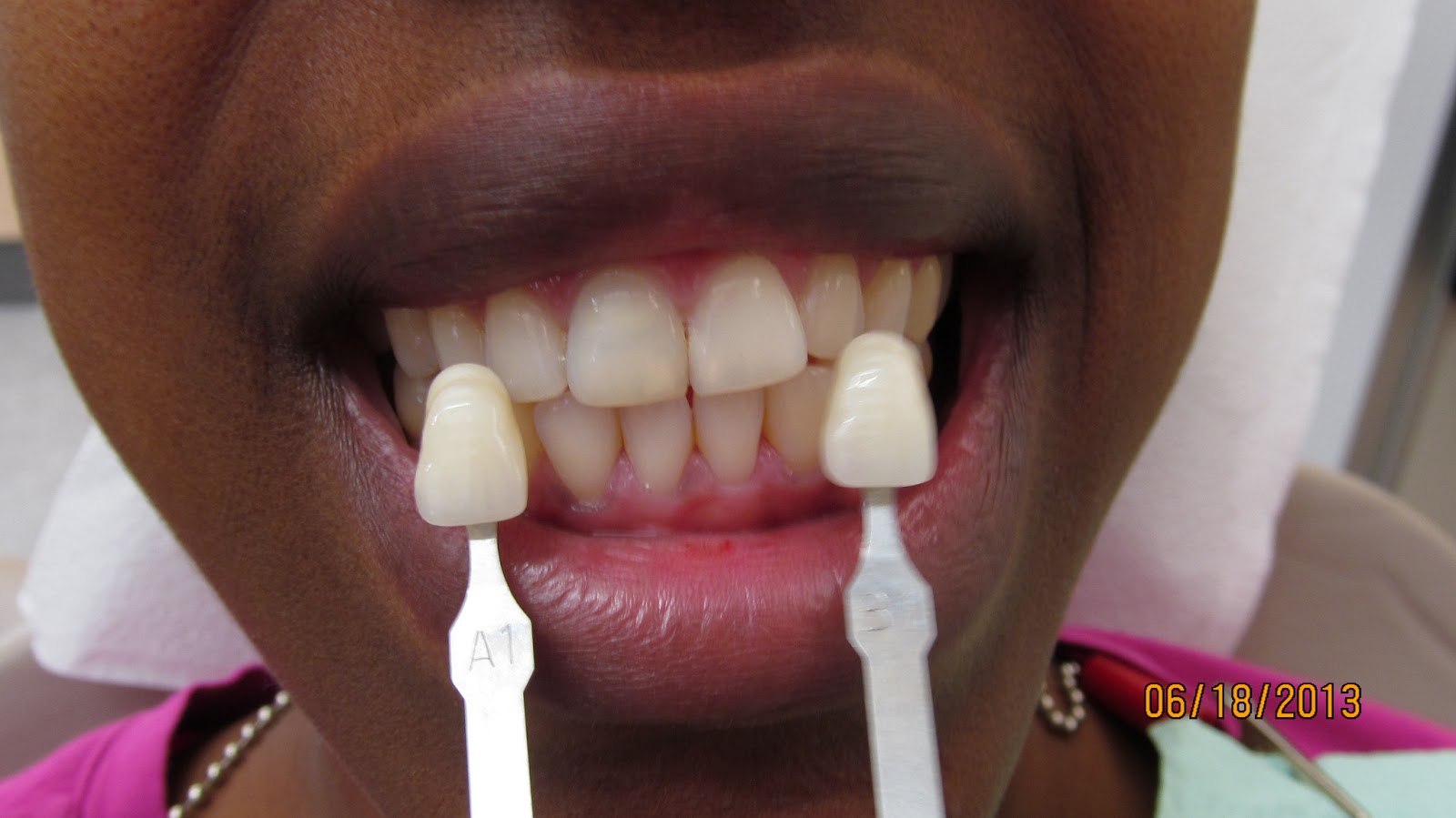 Dental Clinical Case Presentations StepbyStep guides Internal