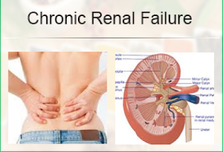  Ramdev Medicine For Chronic Renal Failure