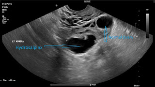 scan%2BJLO-Hydro-1024x576.jpg